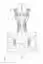 Fig. 02 - System of variable stator vanes for a turbine engine