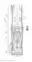 Fig. 02 - Rotating airfoil with tip pocket