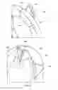 Fig. 04 - Piston sealing ring assembly having a gap cover element