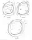 Fig. 05 - Piston sealing ring assembly having a gap cover element