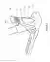 Fig. 03 - Tripod foot