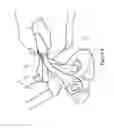 Fig. 05 - Tripod foot
