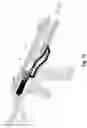 Fig. 08 - Cased telescoped ammunition firearm with headspace reduction