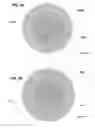 Fig. 09 - Passive aligning optical coupler array