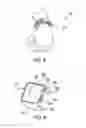 Fig. 04 - Wrist wearable device repositioning assembly