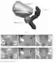Fig. 01 - System and methods for image segmentation using convolutional neural network