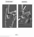 Fig. 06 - Conditional rodent Acvr1 mutant gene