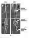 Fig. 08 - Conditional rodent Acvr1 mutant gene