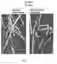 Fig. 09 - Conditional rodent Acvr1 mutant gene