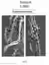 Fig. 10 - Conditional rodent Acvr1 mutant gene