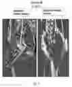 Fig. 12 - Conditional rodent Acvr1 mutant gene