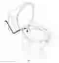 Fig. 02 - Toilet Ventilation Apparatus