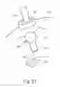 Fig. 22 - A LAPAROSCOPIC TOOL SYSTEM FOR MINIMALLY INVASIVE SURGERY