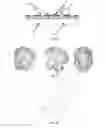 Fig. 10 - PET imaging device for observing the brain