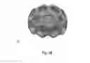 Fig. 11 - PET imaging device for observing the brain