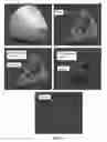 Fig. 09 - Color coding an image for identifying anatomy using quantitative transmission ultrasound tomography