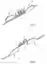 Fig. 04 - Surgical stapler and feeder belt configurations