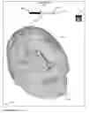 Fig. 11 - Method, system and apparatus for surface rendering using medical imaging data