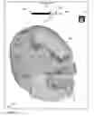 Fig. 12 - Method, system and apparatus for surface rendering using medical imaging data