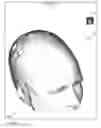Fig. 17 - Method, system and apparatus for surface rendering using medical imaging data