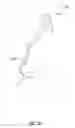 Fig. 35 - Soft tissue balancing in articular surgery