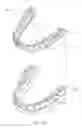 Fig. 02 - Systems, methods, and apparatus for correcting malocclusions of teeth