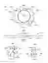 Fig. 02 - Intraocular lens having an asymmetric hinged closed-loop haptic structure