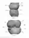 Fig. 09 - Magnetic devices for reducing loading across cartilaginous joints