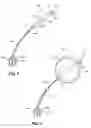 Fig. 02 - Immobilization Device for Radiation Treatment