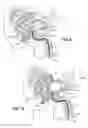 Fig. 06 - Immobilization Device for Radiation Treatment