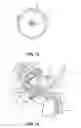 Fig. 08 - Immobilization Device for Radiation Treatment