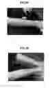 Fig. 04 - METHODS AND COMPOSITIONS FOR TREATING SKIN CONDITIONS