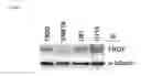 Fig. 05 - Methods of sensitizing a patient with glioma to a therapeutic agent by administering small hairpin RNA targeting PDZ-RHOGEF