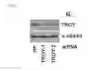 Fig. 06 - Methods of sensitizing a patient with glioma to a therapeutic agent by administering small hairpin RNA targeting PDZ-RHOGEF