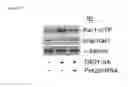 Fig. 16 - Methods of sensitizing a patient with glioma to a therapeutic agent by administering small hairpin RNA targeting PDZ-RHOGEF