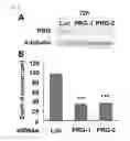 Fig. 34 - Methods of sensitizing a patient with glioma to a therapeutic agent by administering small hairpin RNA targeting PDZ-RHOGEF