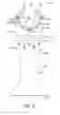 Fig. 03 - Oscillating blade with universal arbor engagement portion