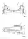 Fig. 02 - Reinforced four-bar linkage