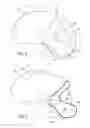 Fig. 06 - Airbag assembly