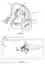 Fig. 07 - Emergency detection and ascent device for a diver