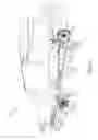 Fig. 04 - Aircraft landing gear and method