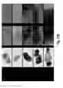 Fig. 72 - ANTIBODIES AGAINST CD73 AND USES THEREOF