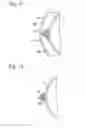 Fig. 09 - CYLINDER DEVICE AND METHOD OF PRODUCING THE SAME