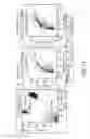Fig. 18 - Diagnostic assays and methods of treating pneumonia, sepsis and systemic inflammatory response syndrome