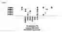 Fig. 02 - ORGAN SPECIFIC DIAGNOSTIC PANELS AND METHODS FOR IDENTIFICATION OF ORGAN SPECIFIC PANEL PROTEINS