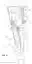 Fig. 09 - TENSIONED PROJECTION SCREEN APPARATUS