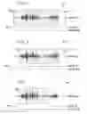 Fig. 04 - System and method for enhancing speech activity detection using facial feature detection