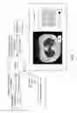 Fig. 11 - Medical scan annotator system