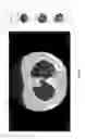 Fig. 15 - Medical scan annotator system