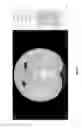 Fig. 23 - Medical scan annotator system